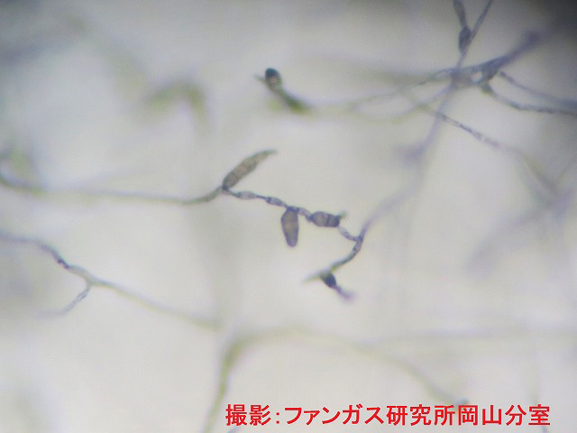 アルテリナリア属